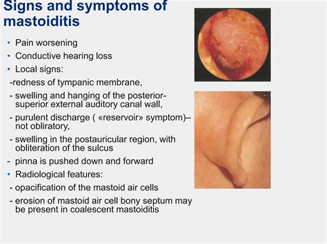 Acute and chronic middle otitis prophylaxis | PPT