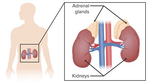 Cushing’s Syndrome vs Adrenal Insufficiency | Lecturio Medical