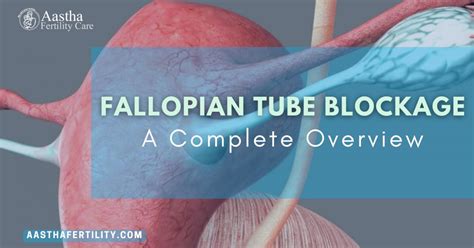 Image result for Fallopian Tube Blockage Surgery