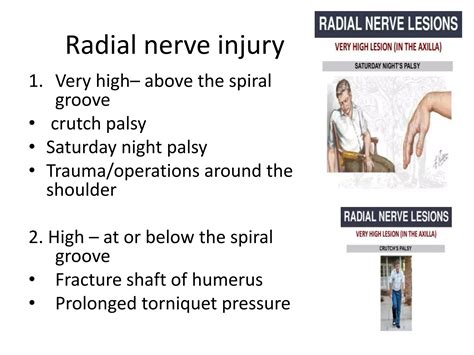 Radial, ulnar and median nerve injuries | PPTX