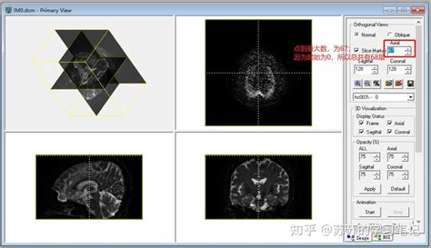 DTI Egg Hunt Tutorial 的图像结果