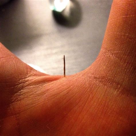 Image result for Splinter in Hand