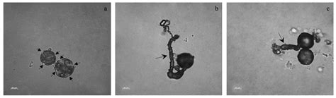 Unravelling the Combined Use of Soil and Microbial Technologies to ...