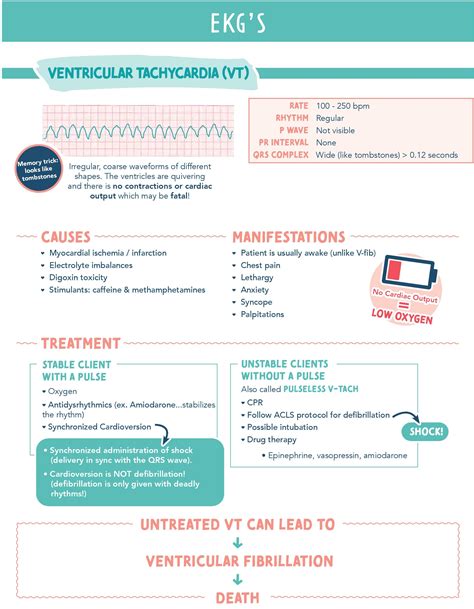 Ventricular Tachycardia (VT) – Causes, Symptoms, EKG Interpretation & Treatment