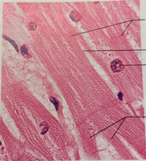 Image result for Cardiac Muscle Labelled Diagram