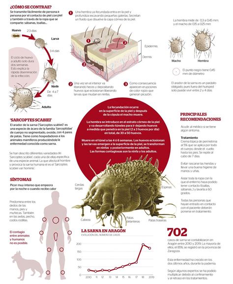 Sarna o escabiosis: una enfermedad con mucha historia