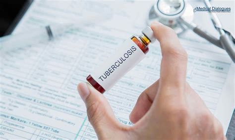 IIT Bhubaneswar, ILS transfer novel TB vaccine technology to TechInvention