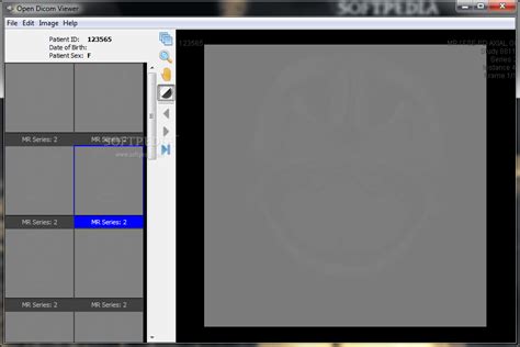 Load File DICOM Viewer 的图像结果