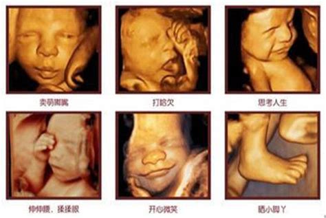 怀孕四个月的胎儿有多大，发育成什么样儿了？很可爱，孕妈们收藏_京妈