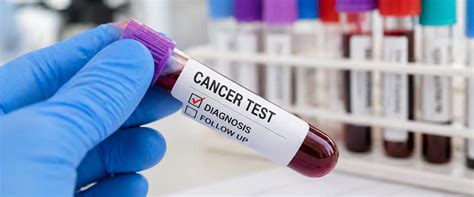 Learn About 5 Common Lab Tests for Cancer Diagnosis | MrMed