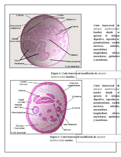 El phylum Nematoda - MORFOLOGIA - Corte transversal de Ascaris lumbricoides hembra donde se ...
