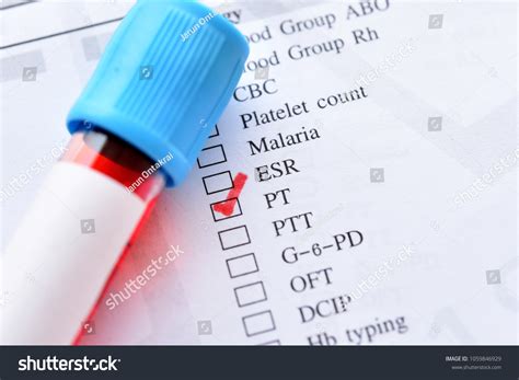 What Color Tube For Pt And Ptt at Michael Brehm blog