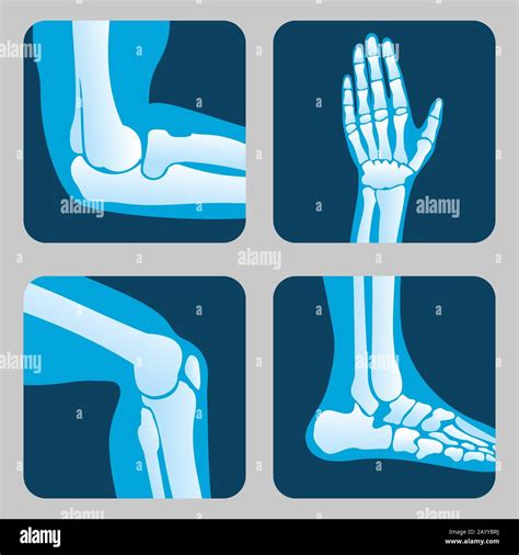 Human joints, knee joint, elbow joint, ankle joint, wrist. Medical orthopedic vector of set ...