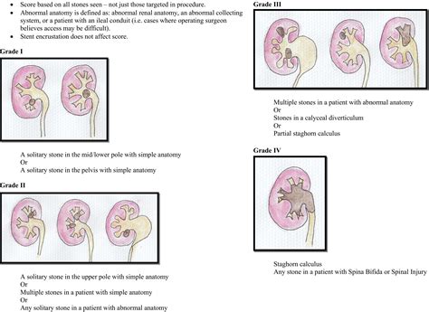 The Guy's Stone Score—Grading the Complexity of Percutaneous ...