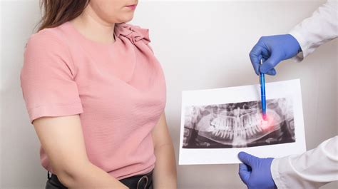 Image result for Wisdom Teeth Removal Procedure