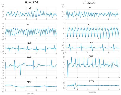Overview of Machine Learning and Deep Learning Approaches for Detecting ...