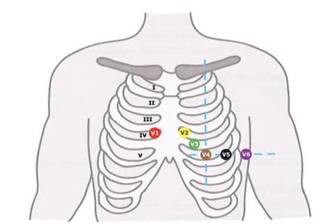 Image result for Lead Optimization Mapper Algorithm