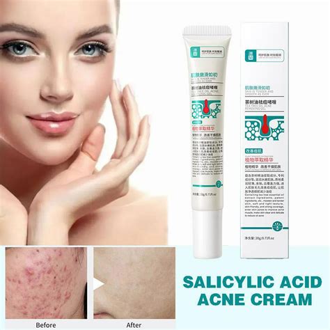Crema para el acné con ácido salicílico Crema para aclarar Aceite de árbol de té Crema para el ...