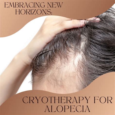 Cryotherapy: A Breakthrough in Alopecia Management | Clinikally