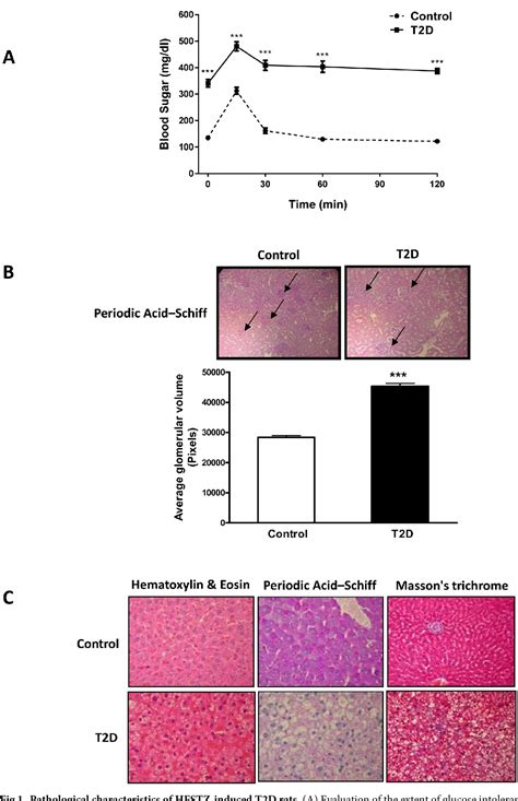 Image result for Post-Translational Modification of Insulin
