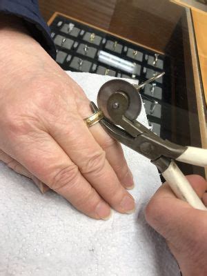 Image result for Ring Removal String Technique