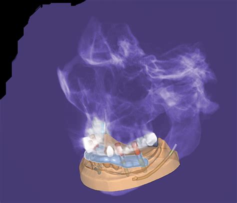 Exoplan Tutorial 的图像结果