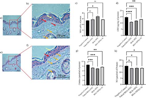 Lipo-polymeric nano-complexes for dermal delivery of a model protein ...