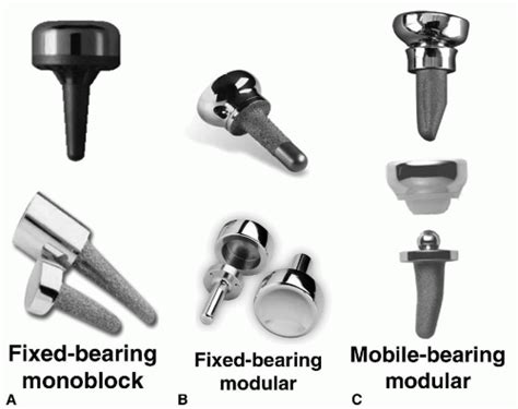 Prosthetic Radial Head 的图像结果