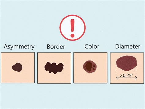 How to Read Hand Moles: Meaning & Importance by Location