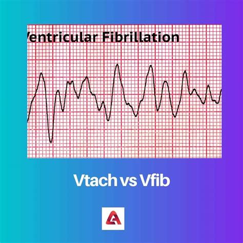 Vtach vs Vfib: Difference and Comparison