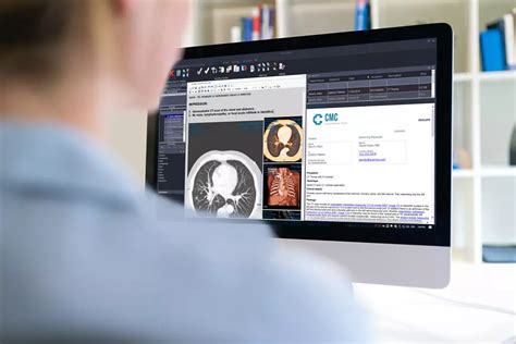 Radiology image management PACS | Philips