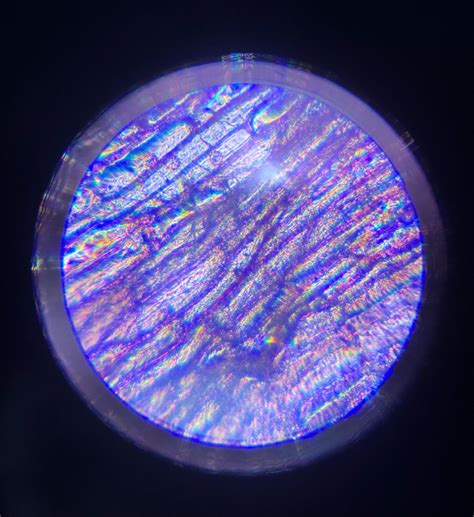 What Does Onion Skin Look Like Under A Microscope at Lewis Powell blog
