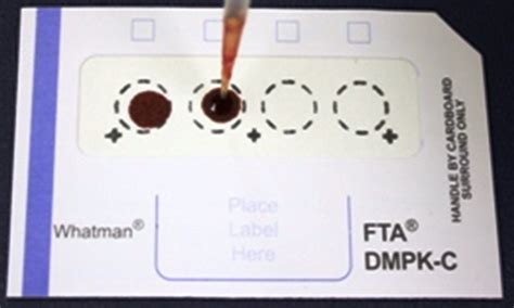 Fig. 1: Representative snap of dried blood spot sampling