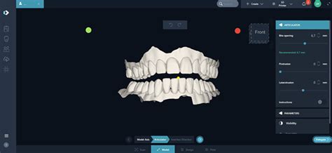 DentaMile Bite Splint Workflow . DentaMile