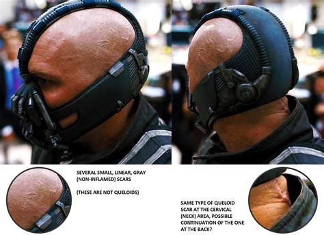 dc - What happened to Bane that requires him to breathe using an ...