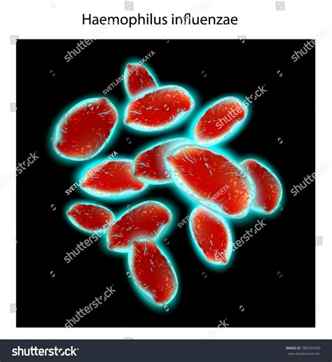 Haemophilus Influenzae Gram Stain Haemophilus Influenzae: