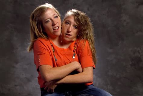 Conjoined Twin Sisters Abigail And Brittany Hensel Ha - vrogue.co