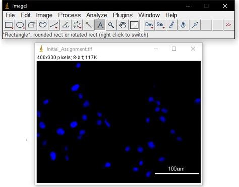 Image result for How to Add Scale Bar On Micrograph