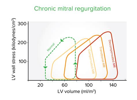 Mitral Regurgitation | Concise Medical Knowledge