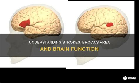 Image result for Broca's area Function