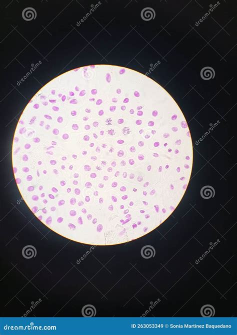 Mitosis Phases Under Microscope