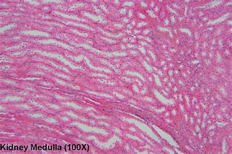 Image result for Kidney Tutorial