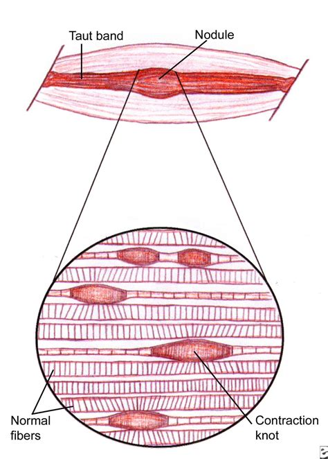 London School of Massage