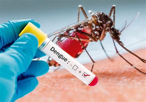 Dengue In Children: बच्चों में दिखें ये लक्षण तो हो सकता है डेंगू का ...