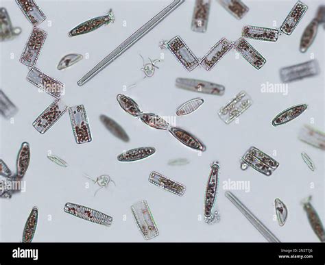 Diatoms Under Microscope