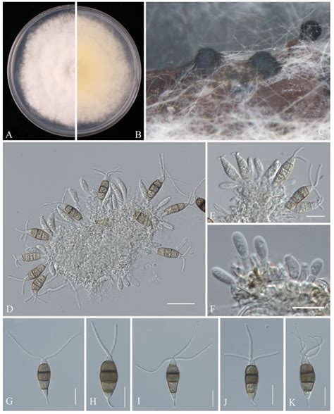 Characterization of Fungal Pathogens Causing Blueberry Fruit Rot ...