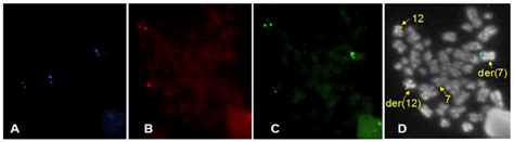 Cancers | Special Issue : Leukemia