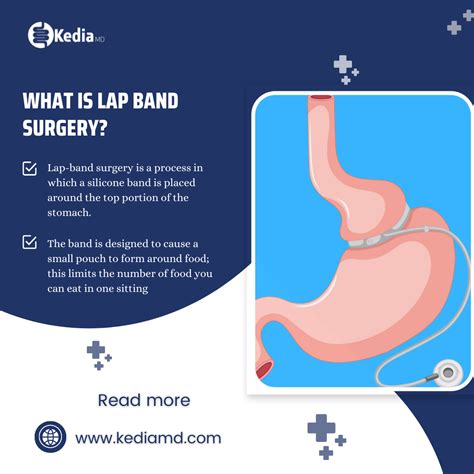 Image result for Lab Band Surgery Risks