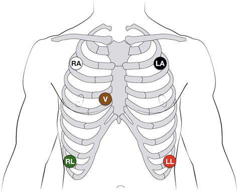 Image result for AFib Detection Algorithm