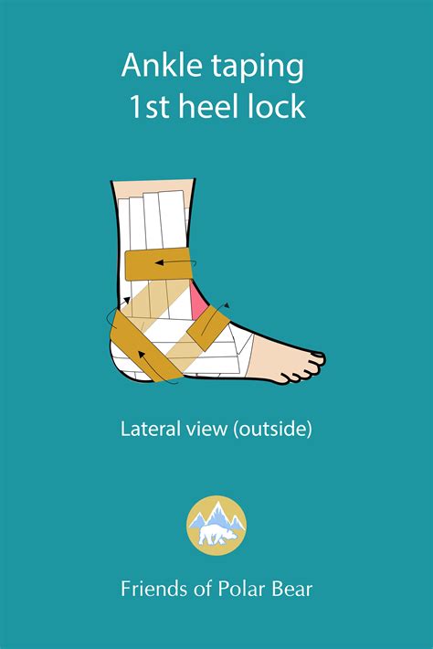 Heel Lock Strapping 的图像结果